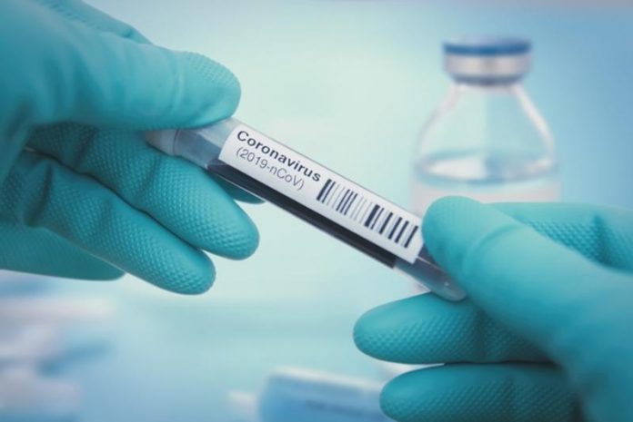 test coronavirus