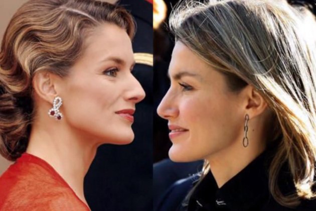 letizia rinoplastia