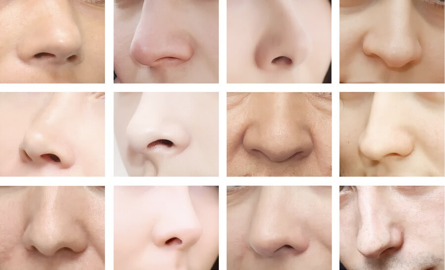 tipos de nariz