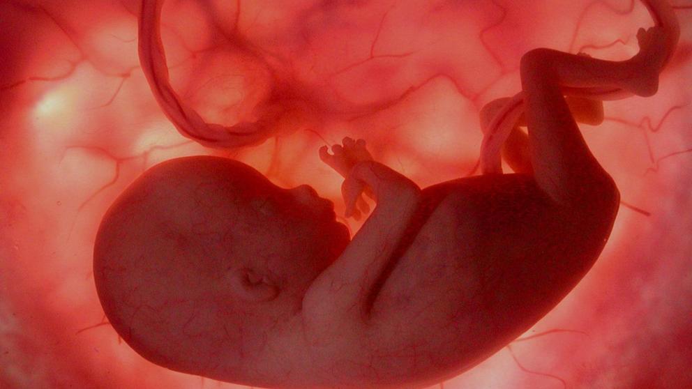 placenta
