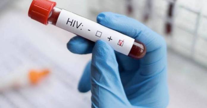 CESIDA avisa de que el Covid-19 pasará pero el VIH seguirá 