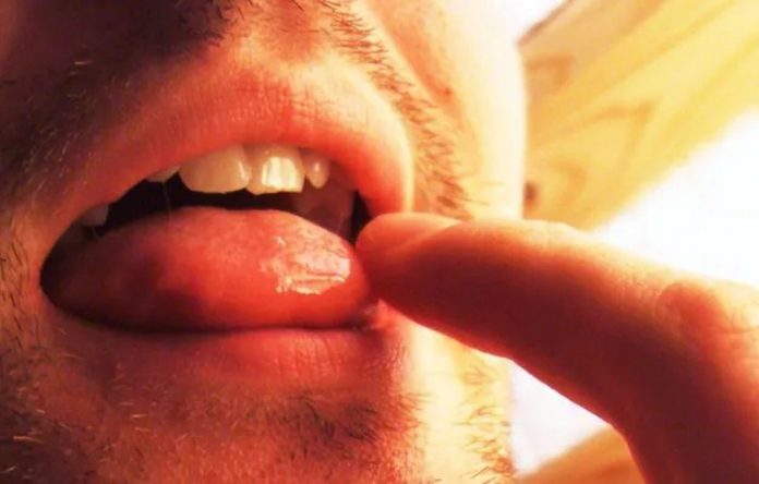 Un estudio revela alteraciones en la lengua como un nuevo síntoma de la Covid-19