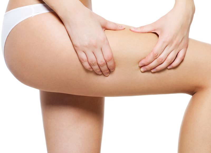 ¿FUNCIONAN LAS CREMAS ANTICELULITIS?