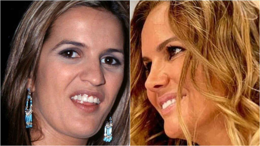 marta lopez antes despues