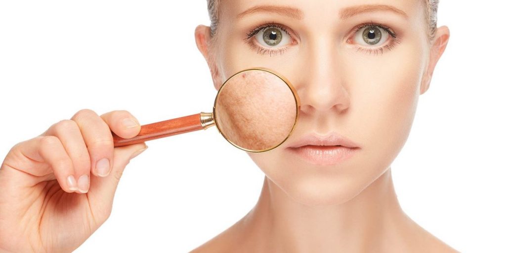 Prevención de manchas en la piel y tratamiento de bellezas