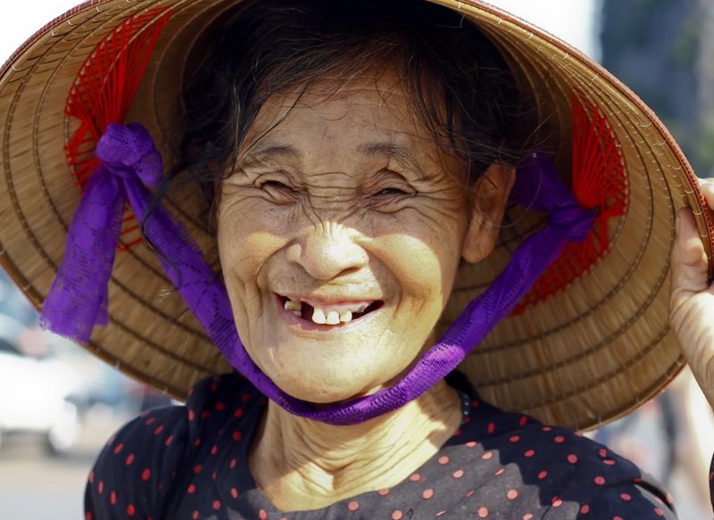 SUEÑO CON LA CAÍDA DE LAS PIEZAS DENTALES SUPERIORES