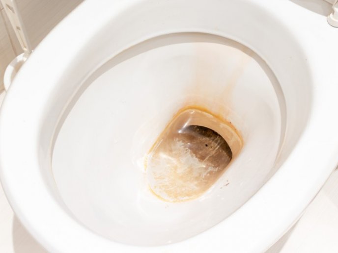 Formas curiosas de dejar tu inodoro como nuevo 2 Moncloa Usa el vinagre blanco y te sorprenderás