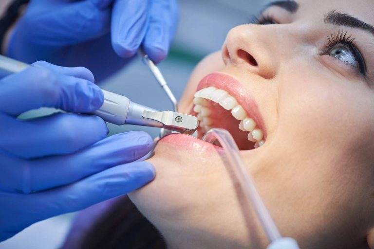 ¿Por qué son importantes las limpiezas dentales profesionales?, por Helident Clínica Dental