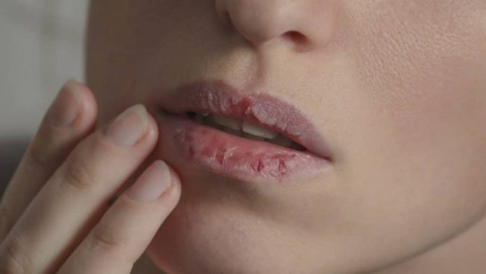 labios