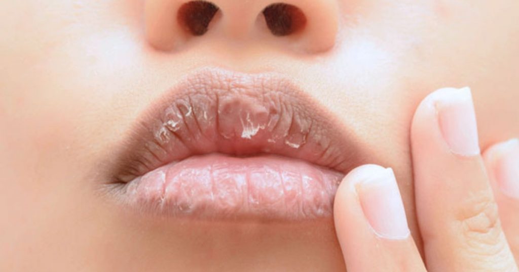 labios secos