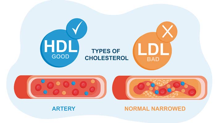 diferencias ldl hdl