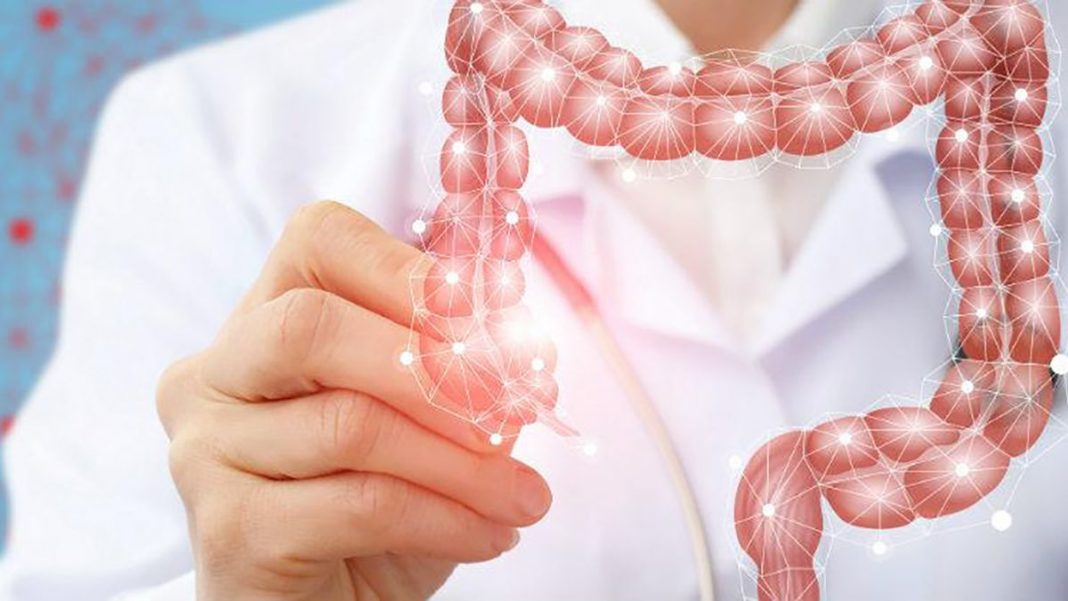 cancer de colon diagnostico