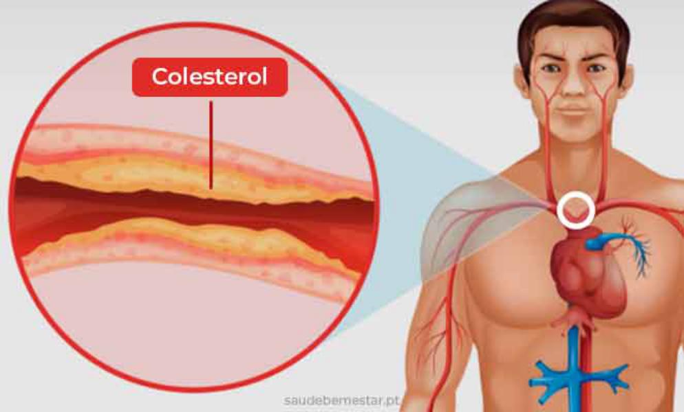 ¿Qué es el colesterol?