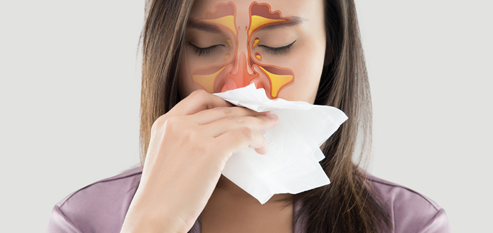 Que-es-el-sindrome-de-alergia-oral-y-que-relacion-tiene-con-la-del-polen