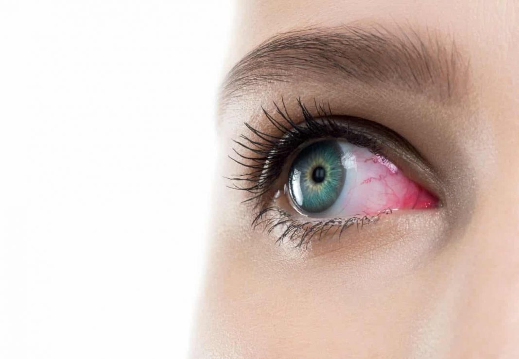 lentillas