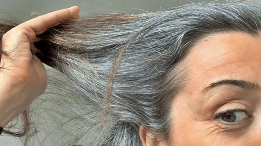 ¿A qué edad se presentan las canas?