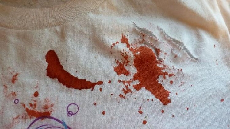El truco para eliminar las manchas de sangre de la ropa 4 Moncloa Utilice agua fría para eliminar las manchas de sangre