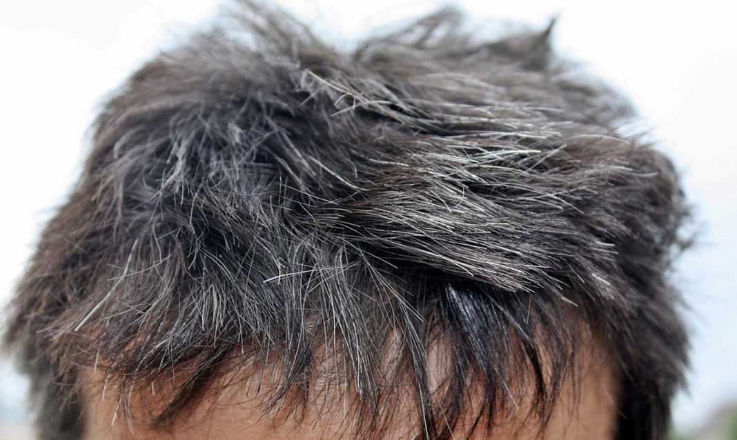 Formas de prevenir las canas