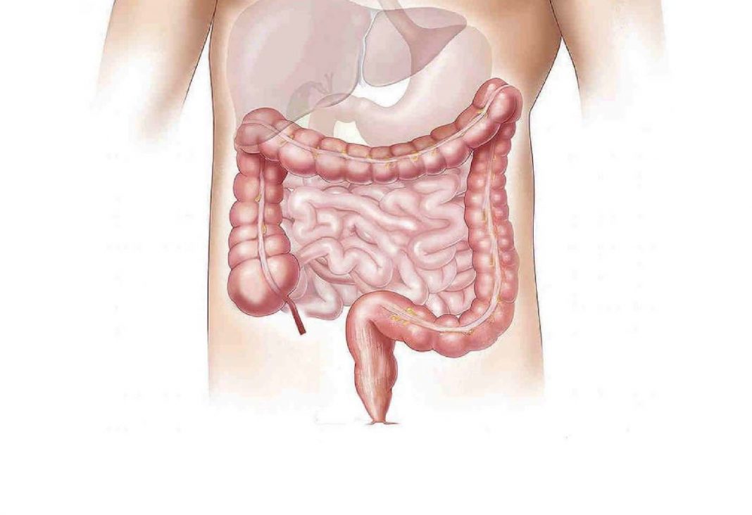 Detección temprana del cáncer de colon
