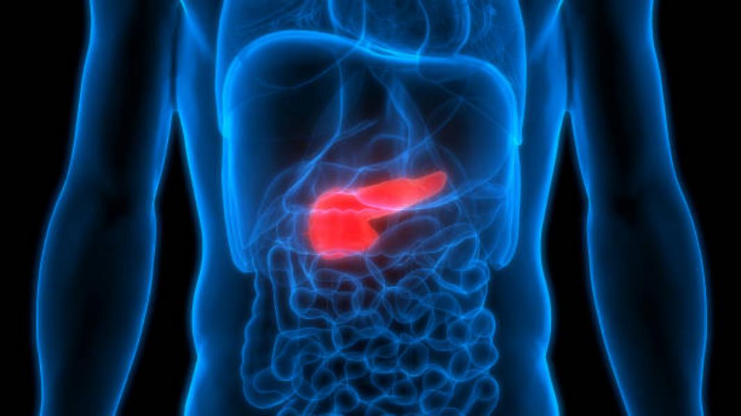 El síntoma más frecuente de cáncer de páncreas