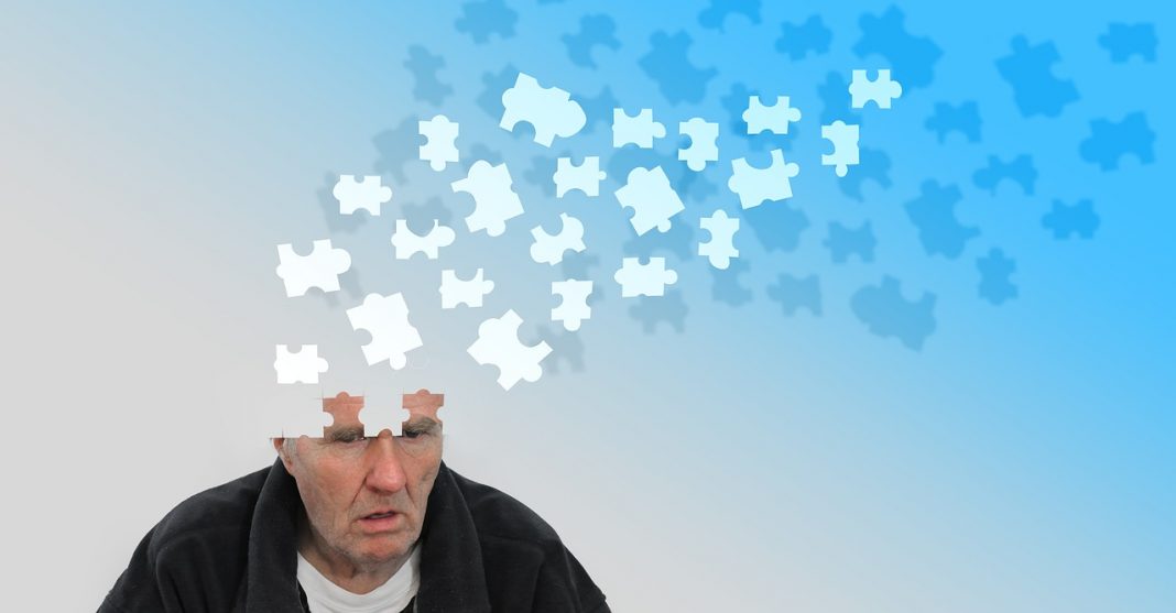 que es alzheimer