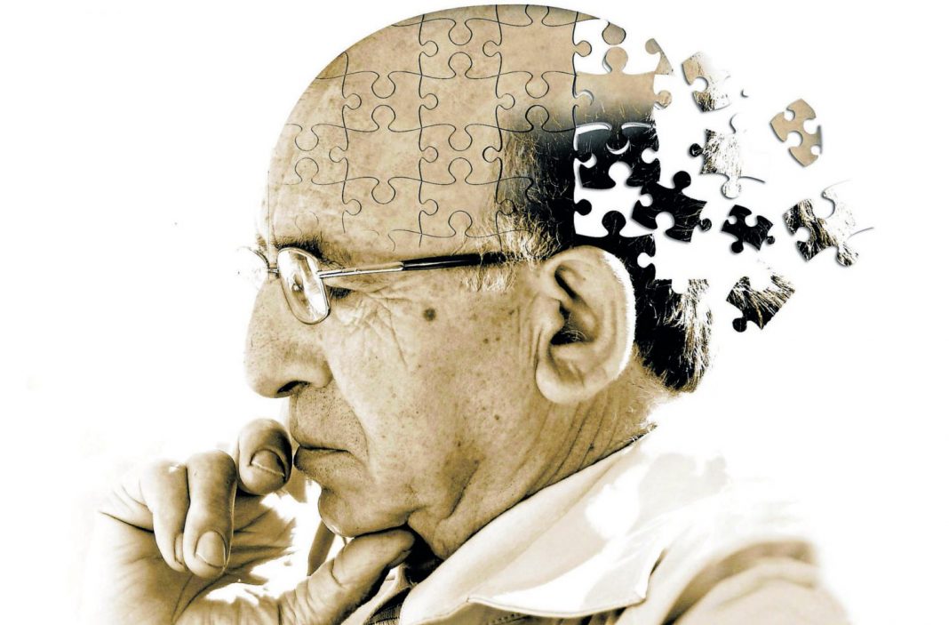 ¿Qué decía el estudio sobre el Alzheimer?