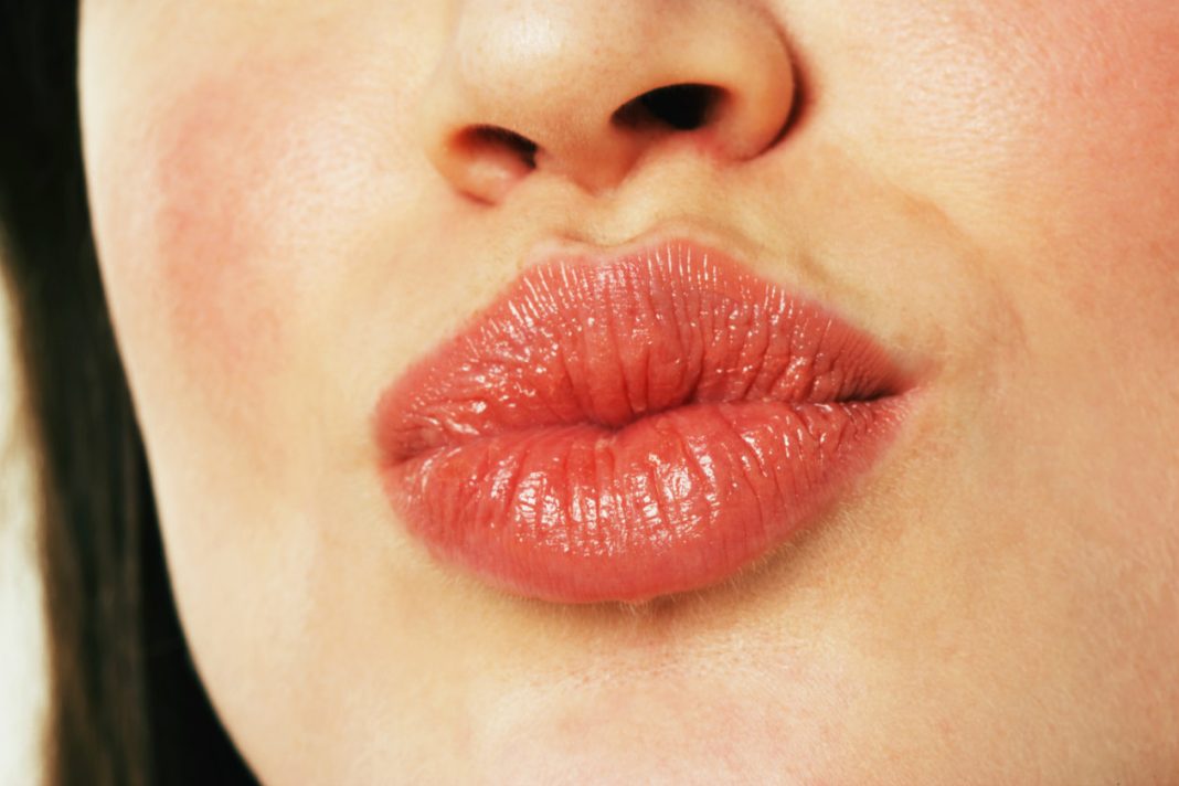 labios