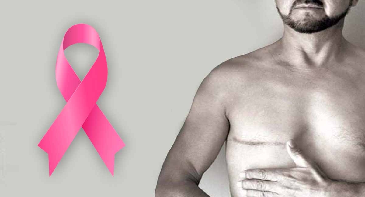 Cáncer de mama en hombres: 5 síntomas que debes tener en cuenta 1 Moncloa Cambios en la piel como síntoma