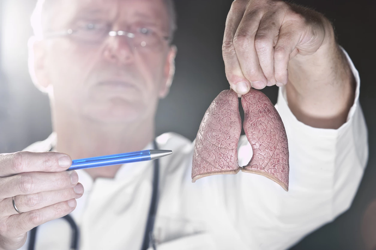 Cáncer de pulmón: la importancia de las pruebas de detección temprana 3 Moncloa La detección temprana puede ayudar a identificar factores de riesgo genéticos para el cáncer de pulmón
