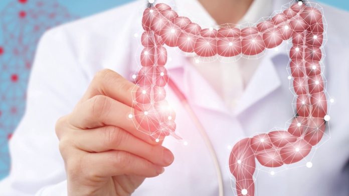 cáncer colorrectal