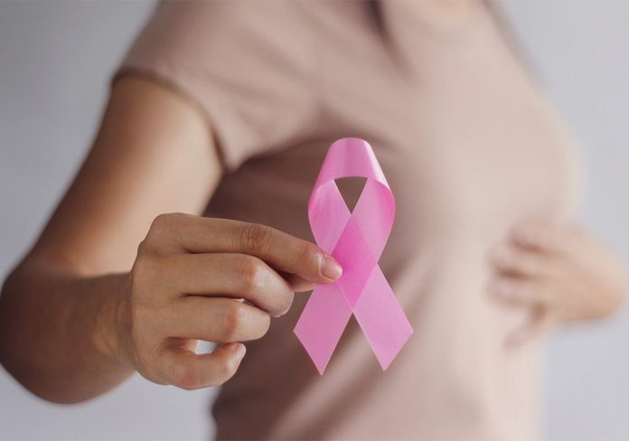 cáncer de mama