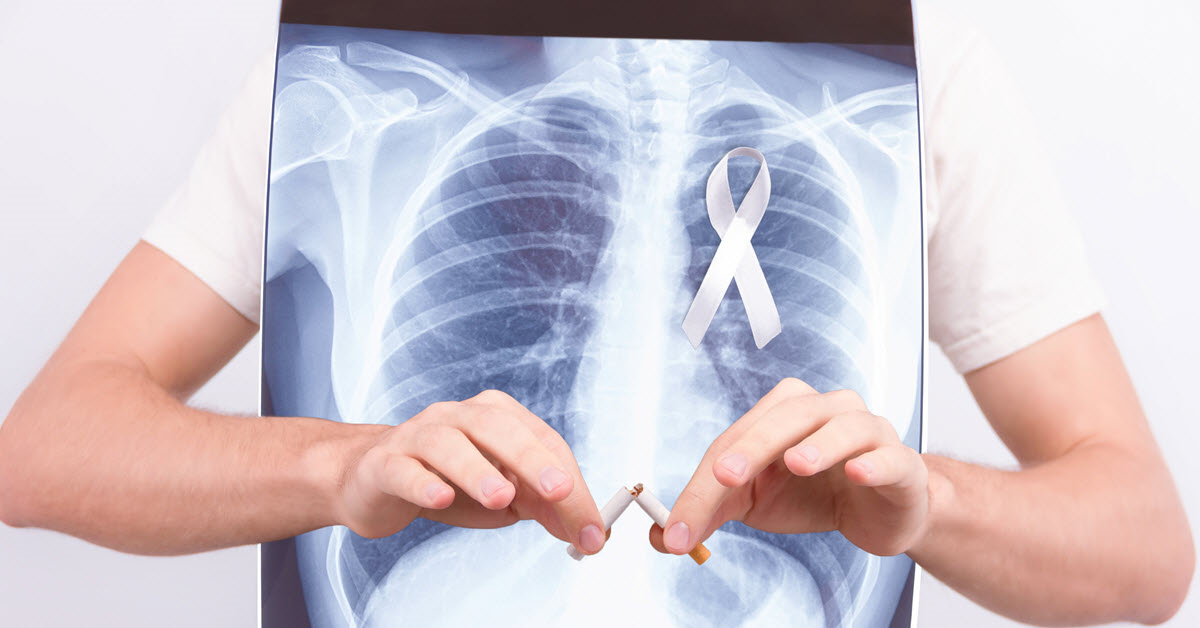 Cáncer: por qué la detección temprana salva vidas 2 Moncloa ¿Quién debería hacerse una prueba de detección temprana?