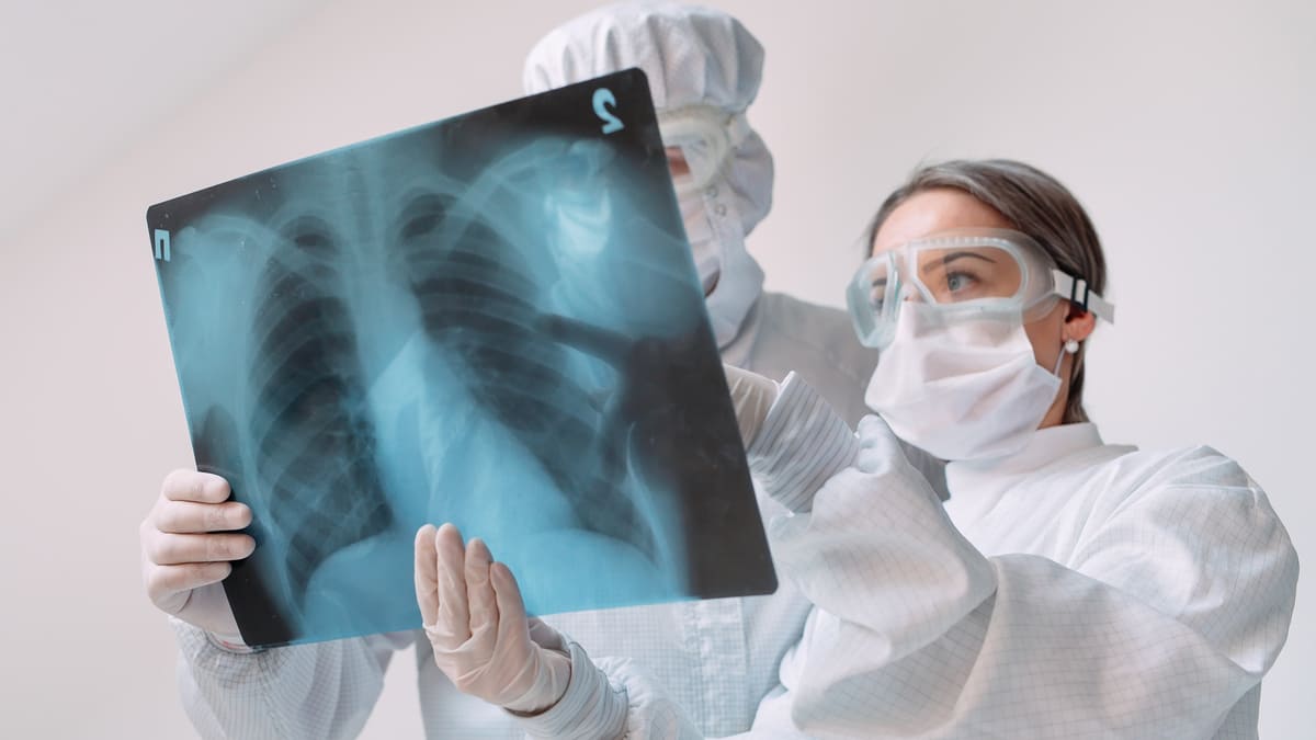 Quién está en riesgo de desarrollar tuberculosis