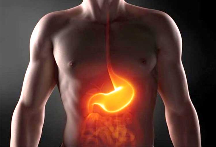 Acidez estomacal frecuente: como controlar el reflujo gastroesofágico 1 Moncloa Cuáles son los factores de riesgo
