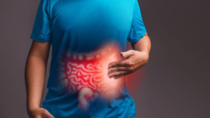 intestino irritable