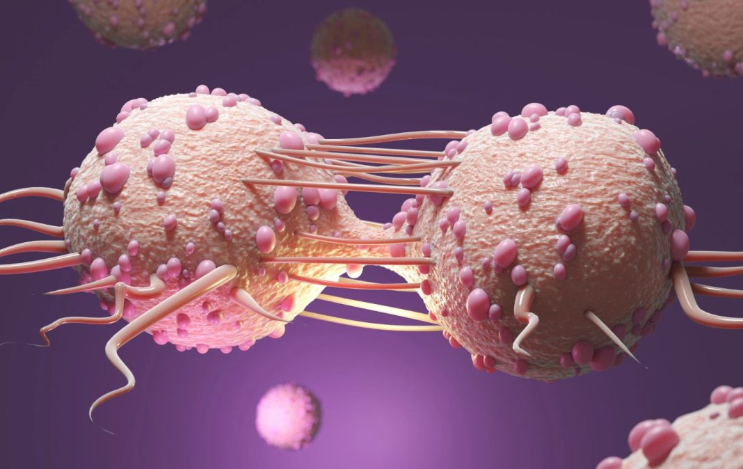 cáncer de mama