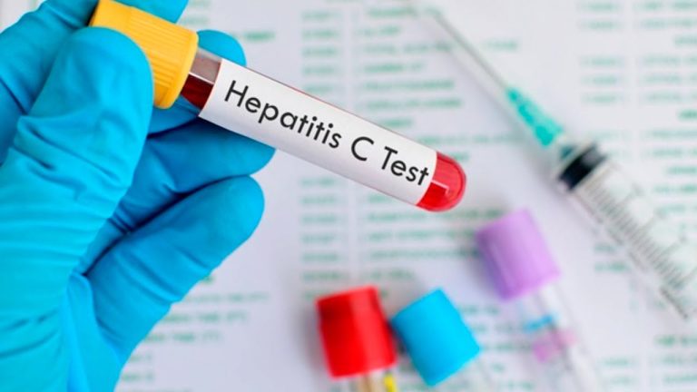 España podría ser el primer país en erradicar la Hepatitis C