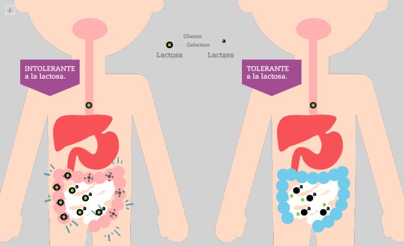 intolerante lactosa Moncloa