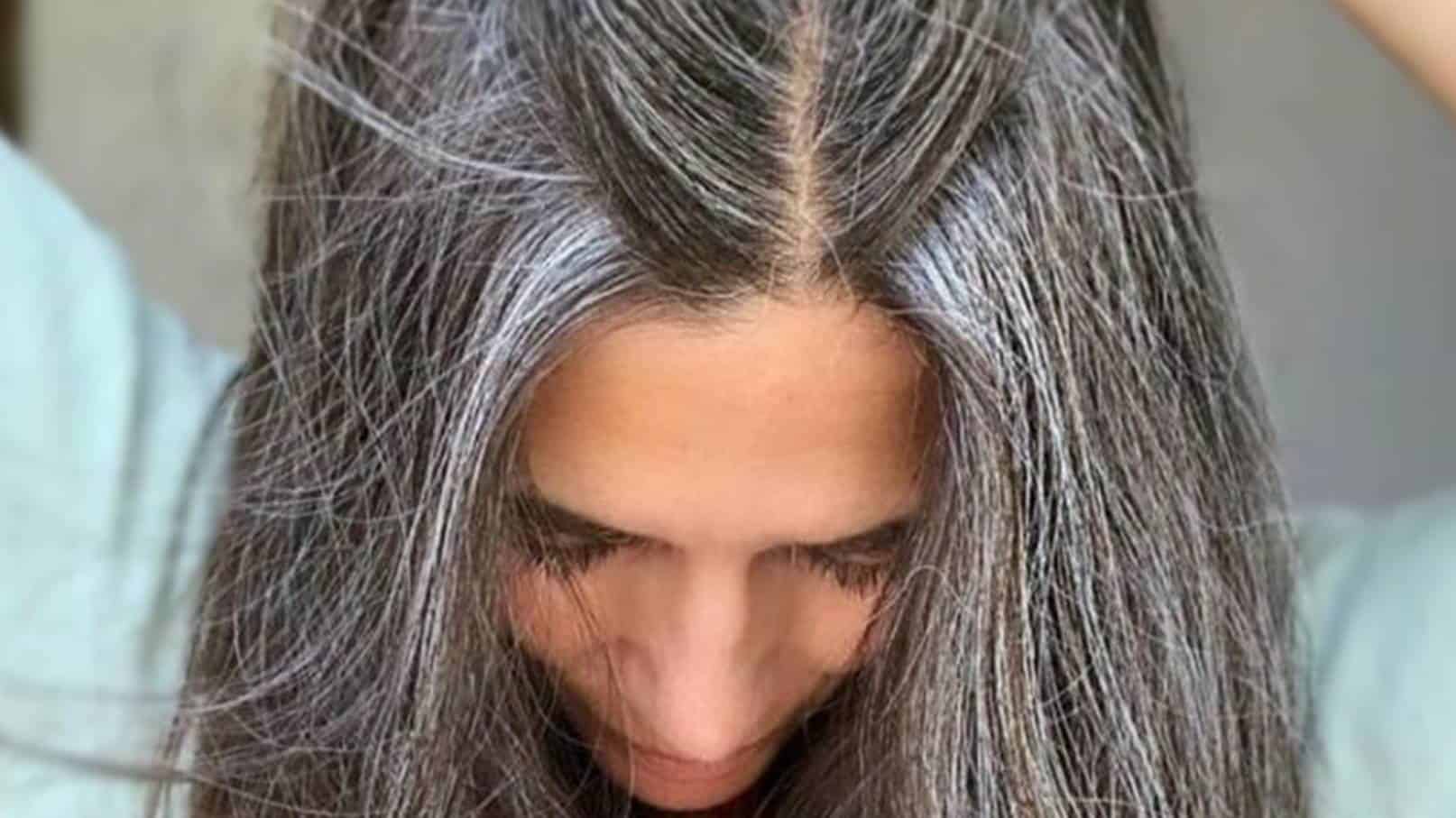 Láser para eliminar las canas best sale