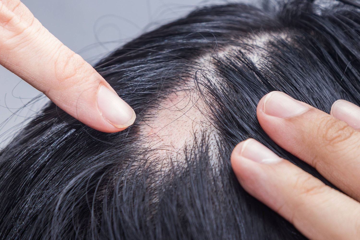 Descubre 7 soluciones naturales para combatir la alopecia. Estrategias efectivas respaldadas por la sabiduría ancestral y la ciencia 2 Moncloa CIENCIA QUE RESPALDA LA TRADICIÓN
