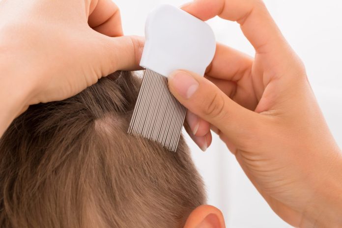 Descubre 5 efectivos remedios caseros contra los piojos, una solución experta y natural para combatir infestaciones capilares