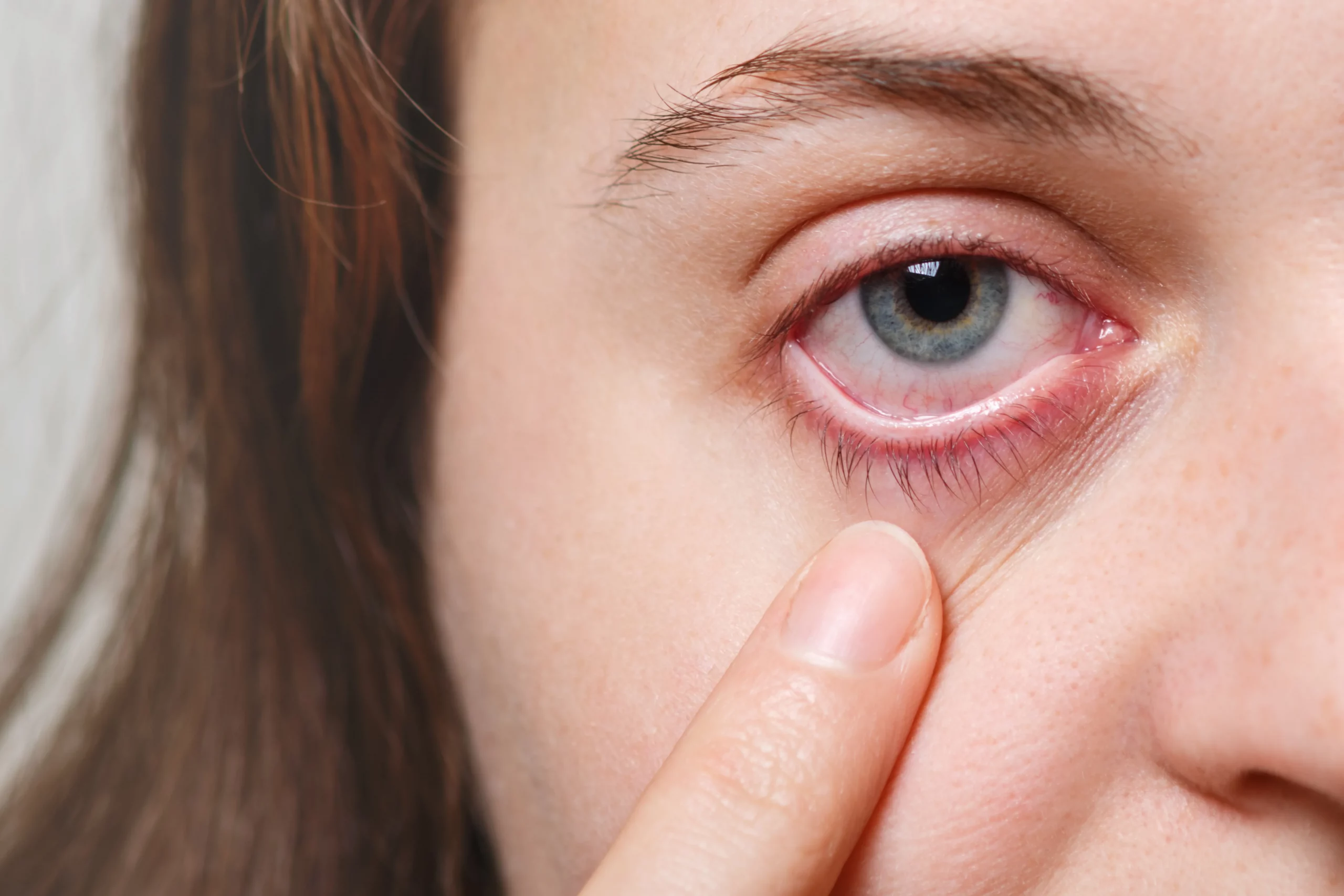 Ojos radiantes: 6 soluciones infalibles para aliviar el enrojecimiento y recuperar la frescura de tu mirada 3 Moncloa REVISIÓN Y PREVENCIÓN: LA IMPORTANCIA DE LOS EXÁMENES OCULARES
