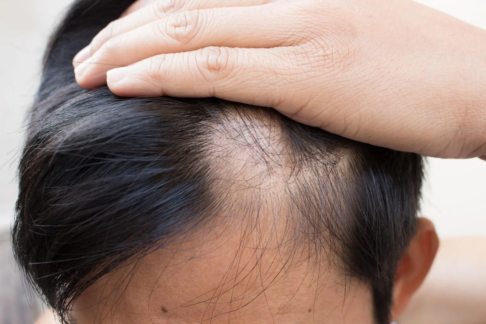 Descubre 7 soluciones naturales para combatir la alopecia. Estrategias efectivas respaldadas por la sabiduría ancestral y la ciencia 1 Moncloa LA NATURALEZA EN TU CABELLO
