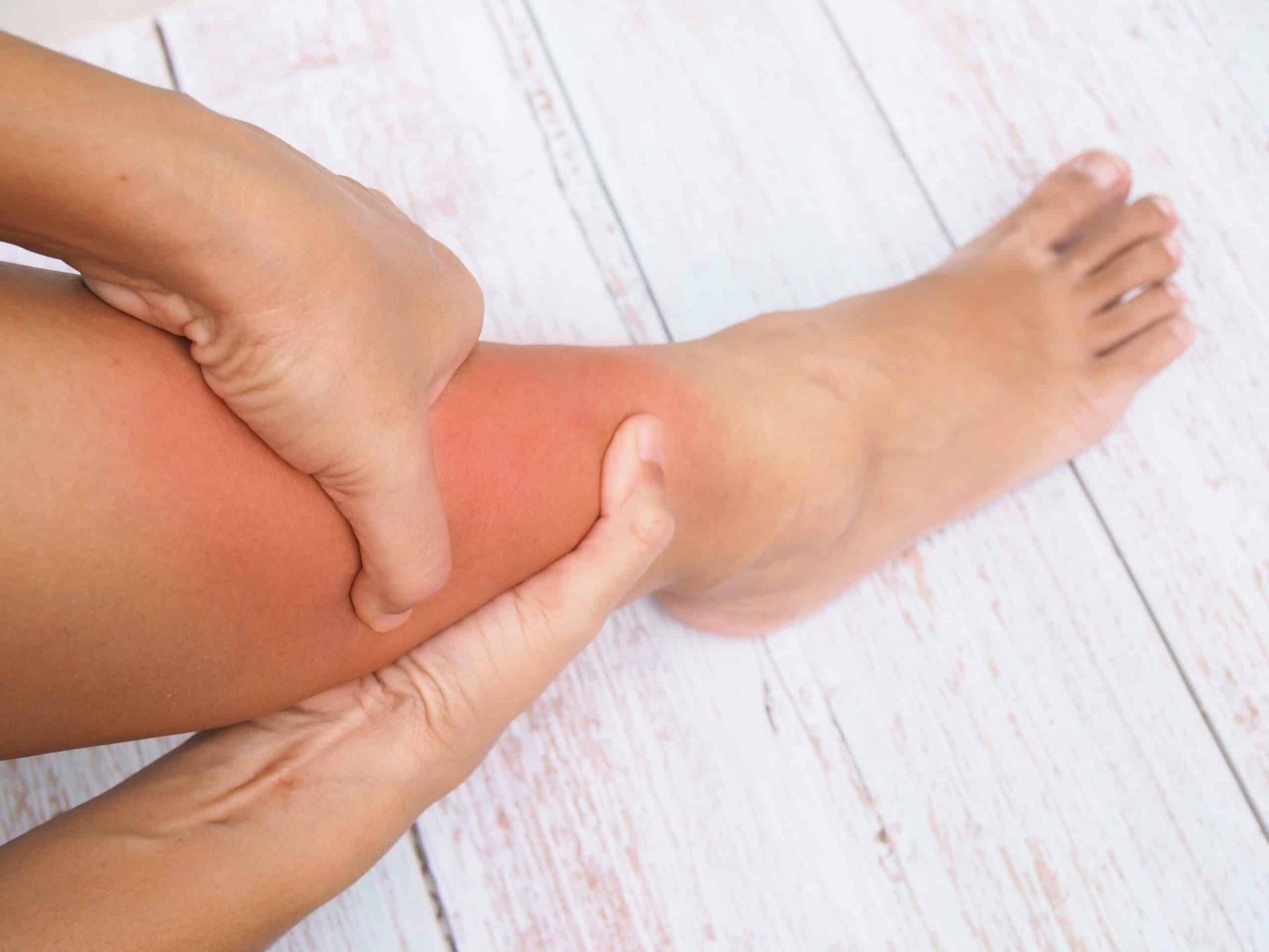 Descubre la solución: 11 remedios caseros infalibles para aliviar las piernas hinchadas. ¡Recupera tu bienestar hoy mismo!