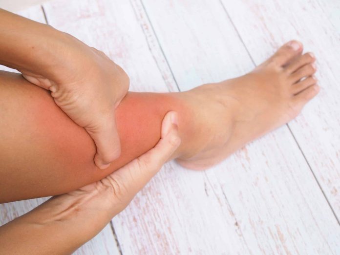 Descubre la solución: 11 remedios caseros infalibles para aliviar las piernas hinchadas. ¡Recupera tu bienestar hoy mismo!