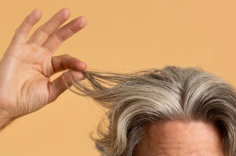 5 enfermedades relacionadas con la aparición de canas prematuras
