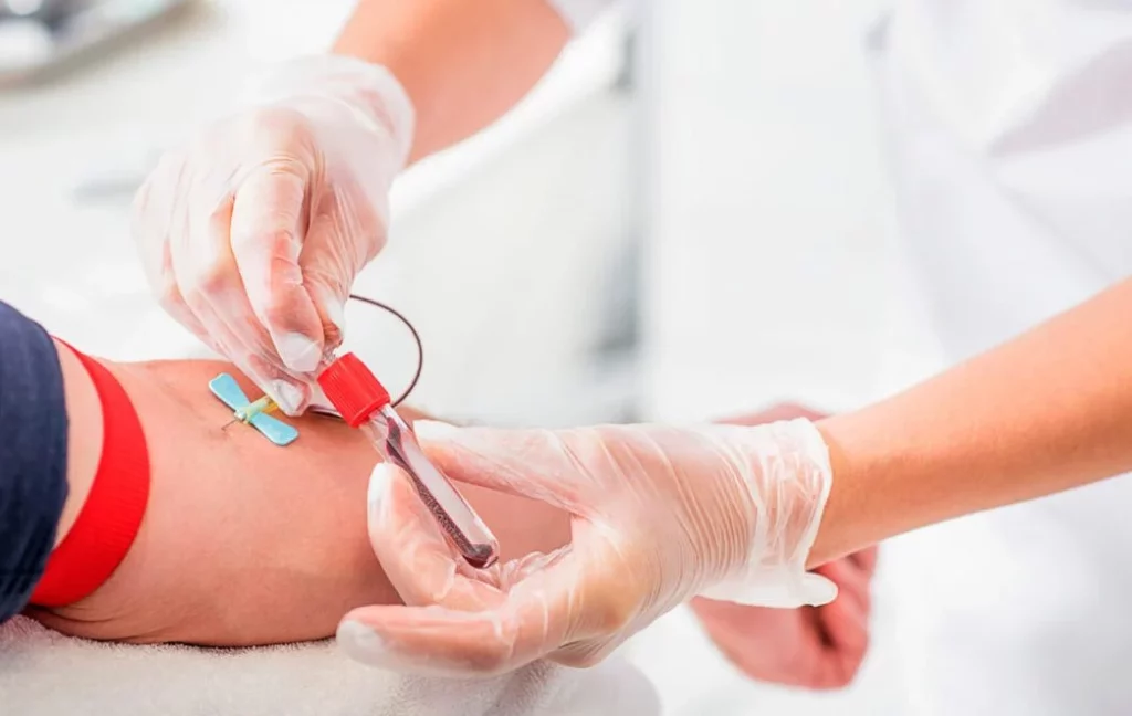 ¿Que se debe hacer para realizarse una PSA?
