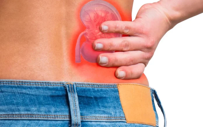 ¿Piedras en los riñones? Esta es la dieta que debes seguir