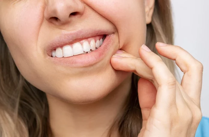 Esta es la hierba medicinal ideal para acabar con la sensibilidad en los dientes