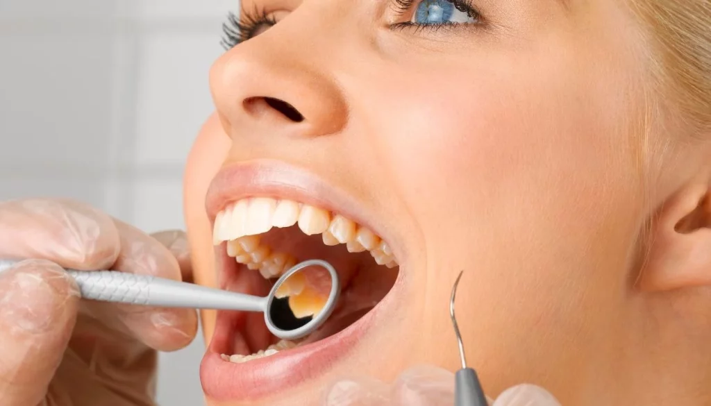 Tips para tener una buena salud bucal y evitar la caries dental
